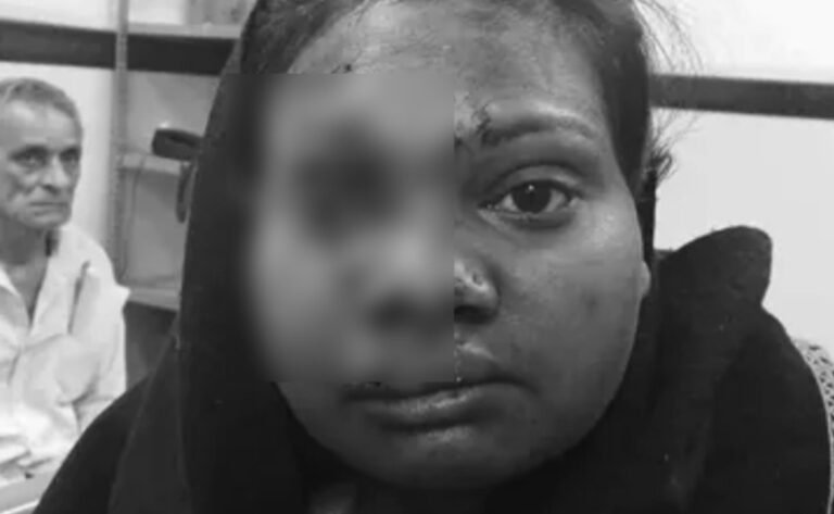 बॉयफ्रेंड ने बार में शराब की बोतल से